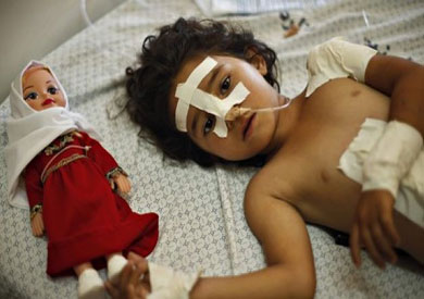 احد الأطفال المصابين أثر القصف الإسرائيلي على قطاع غزة